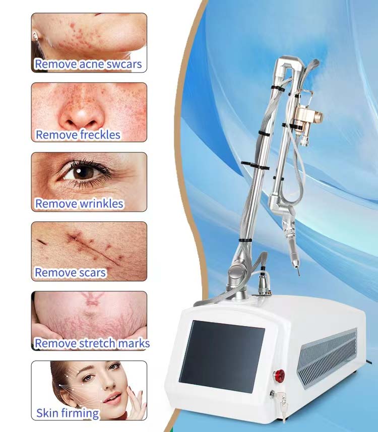  Fractional Co2 Laser 