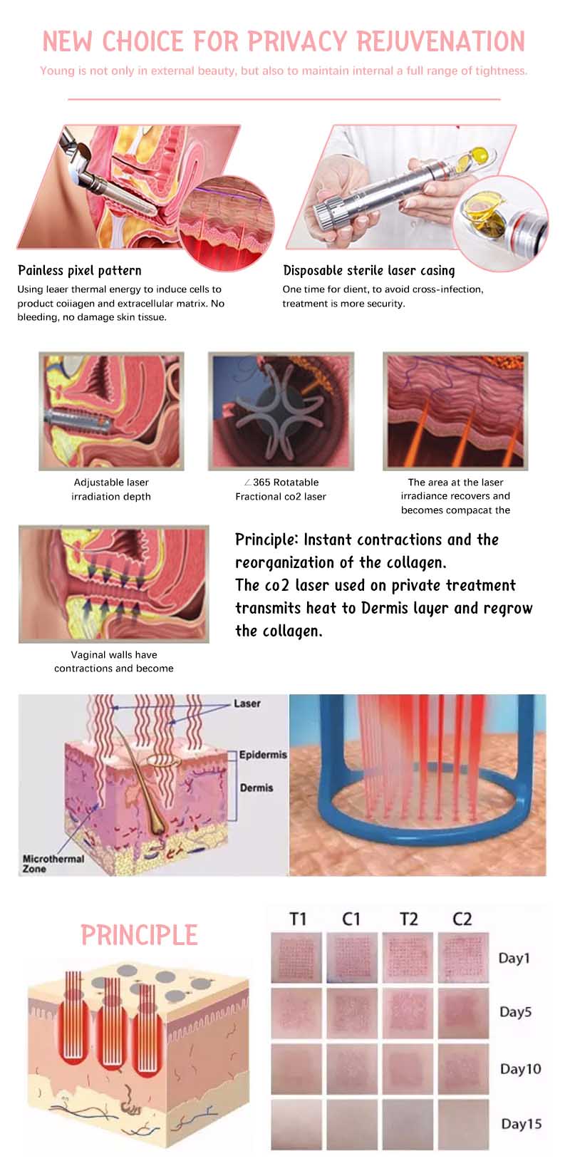 Laser Co2 Fractional Scars Removal