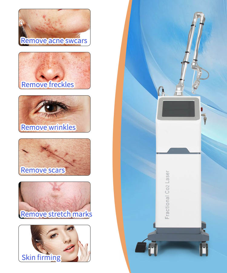 Pigment Removal Co2 Laser