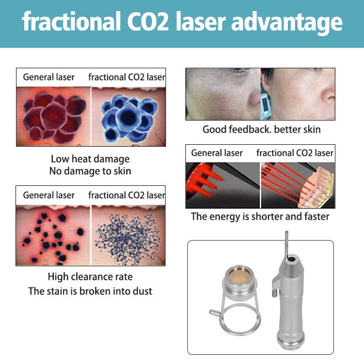 Co2 Fractional Laser